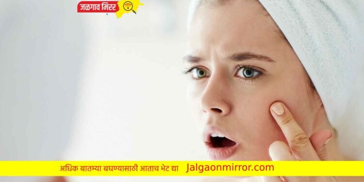 थंडीत मुलायम त्वचेसाठी हे उपाय करू शकता !