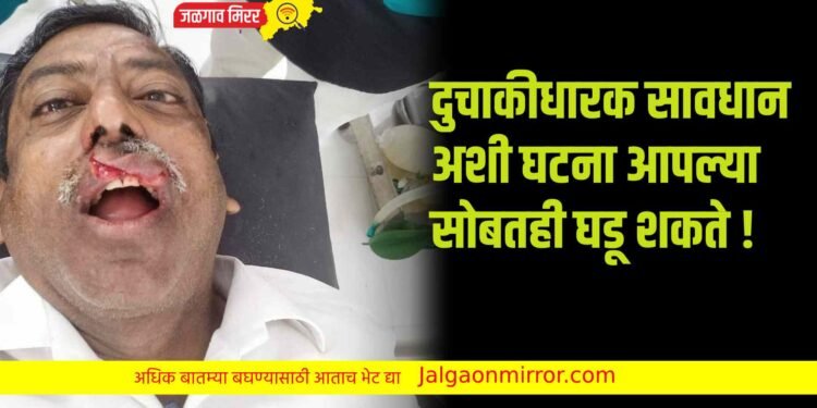 दुचाकीधारक सावधान : अशी घटना आपल्या सोबतही घडू शकते !