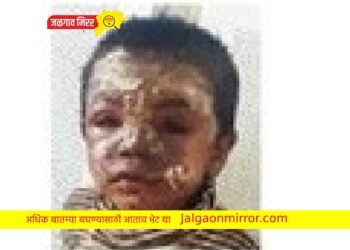 जळगावात उकळता चहा पडल्याने बालक जखमी !