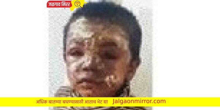 जळगावात उकळता चहा पडल्याने बालक जखमी !