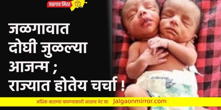 जळगावात दोघी जुळल्या आजन्म ; राज्यात होतेय चर्चा !