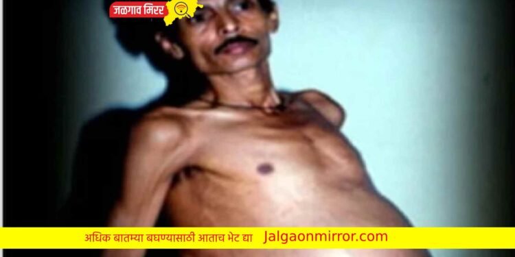 पुरुष झाला ३६ वर्षे प्रेग्नंट ; नागपुरात घडली घटना !