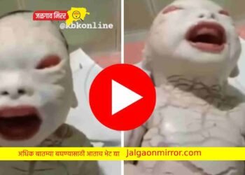 आईच्या पोटी जन्माला आले असे बाळ ; डॉक्टरांना बसला धक्का !