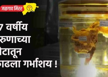 २७ वर्षीय तरुणाच्या पोटातून काढला गर्भाशय !