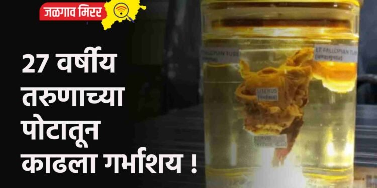 २७ वर्षीय तरुणाच्या पोटातून काढला गर्भाशय !