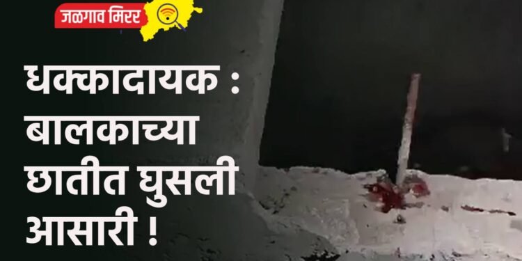 धक्कादायक : बालकाच्या छातीत घुसली आसारी !