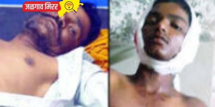 दोन मजुरांवर रानडुकराचा हल्ला